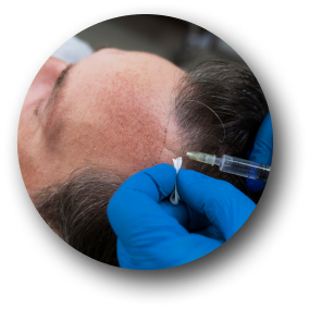 Hair Treatment 2